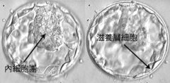 囊胚移植(Blastocyst Transfer)